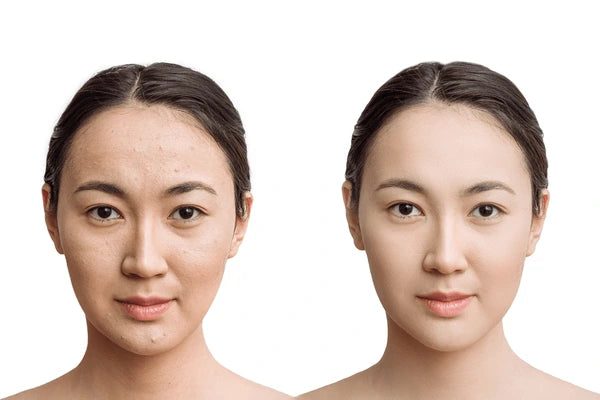 Korean Mask + Buy 1 Get 1