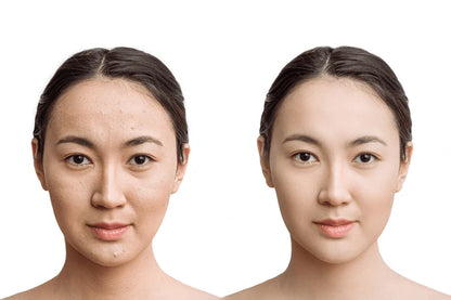 Korean Mask + Buy 1 Get 1
